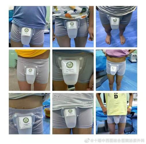 暑假,包皮手术火热进行中