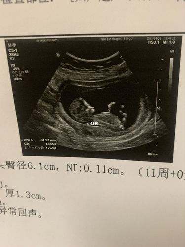 (男女都喜欢,只是性格问题好奇心太重了)