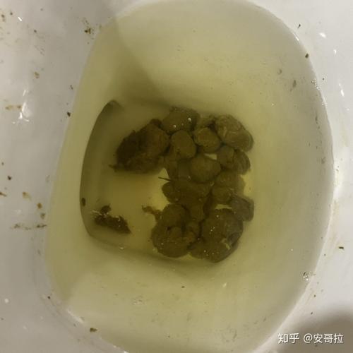 大便颗粒状是什么原因