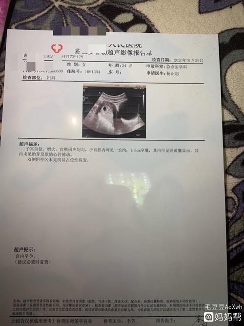刚怀孕35天做的b超,看大家都发图看男女