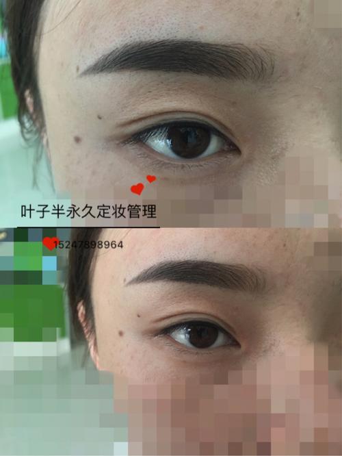 恢复一个月后的轻氧眉