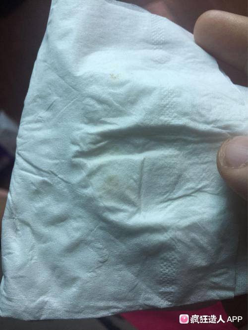 今天白带变黄,水样,咋回事不知道怕