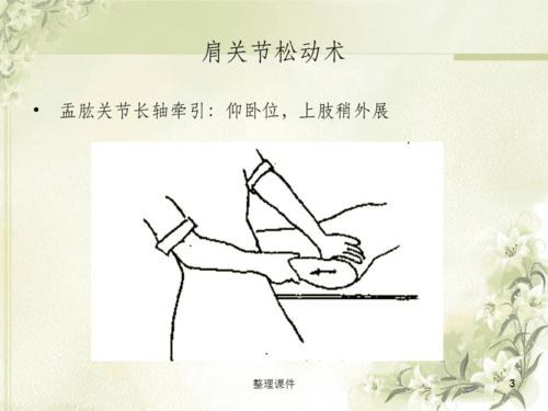 《肩关节松动术》