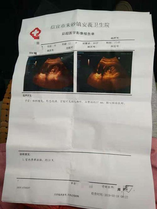 邱女士提供的一份落款时间为2019年3月18日的"彩照医学影像报告单"