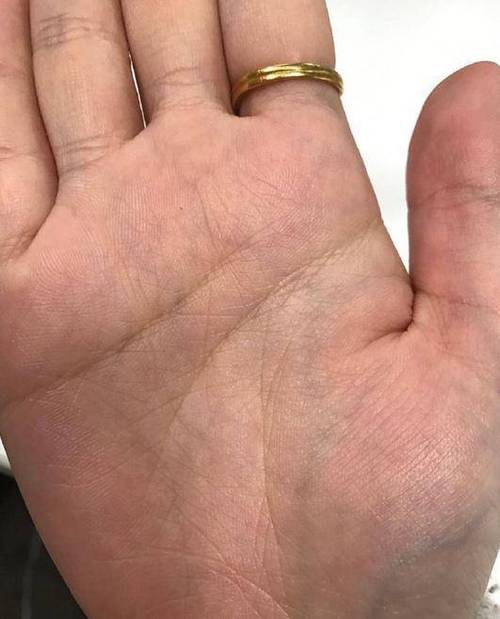 感情线锁链状,婚姻线