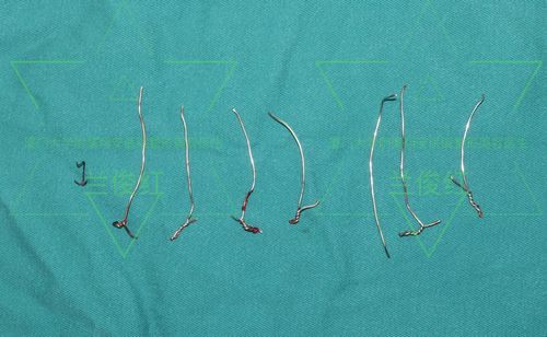 开胸后手术切口愈合不良,有救了