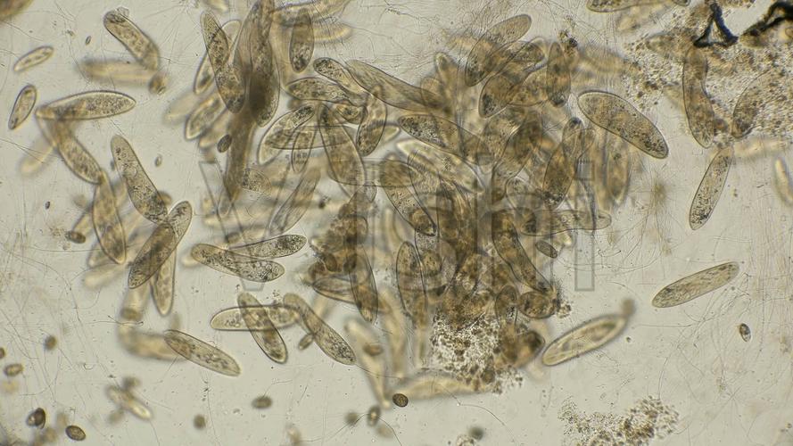 显微镜下的大菌落副滴虫_3840x2160_高清视频素材下载(编号:6207588)