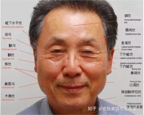 皱纹,松垂,凹陷.面部衰老的原因和对策,你都知道
