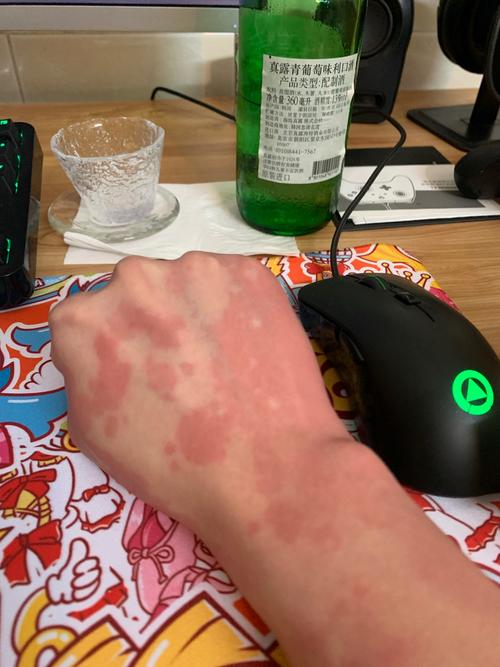 这是酒精过敏求大神帮我分析一下