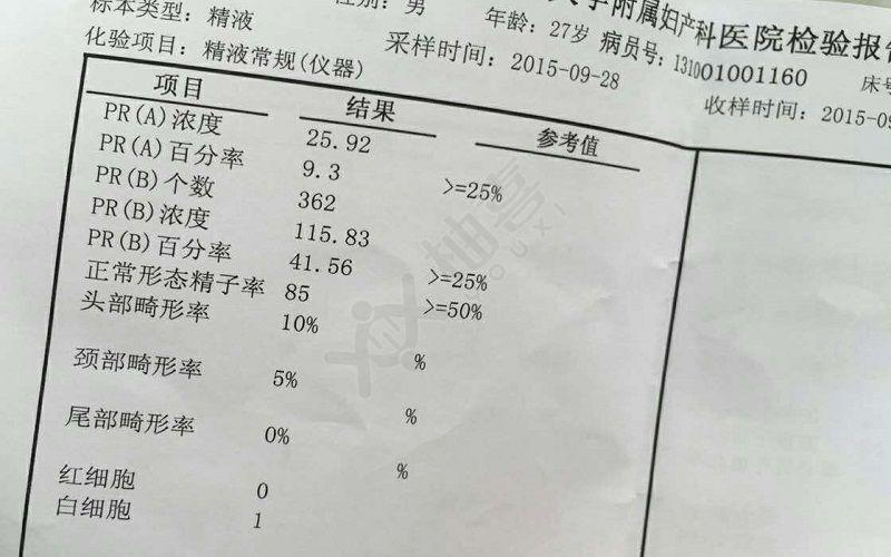 各项数值共同表示精子的质量