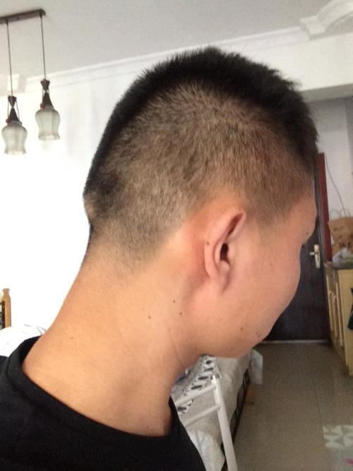 我后脑勺有一块骨头凸起,从小学就开始有了.理个短发