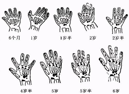 孩子出现这 3 种情况,需要马上测骨龄,家长们要注意了