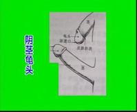 我的阴茎正常吗?