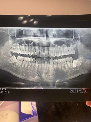 还有人记得我的经典牙片吗