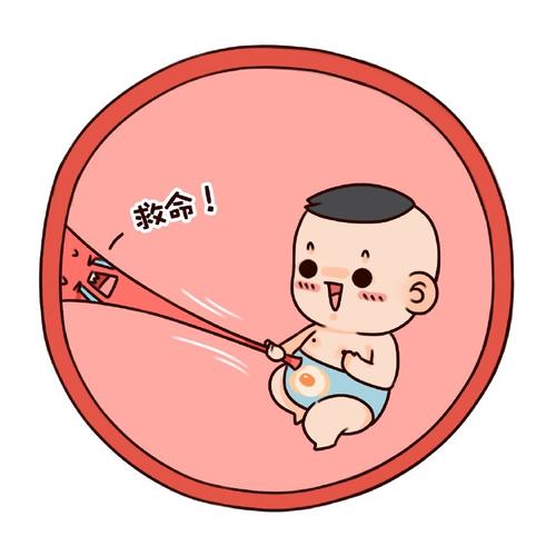 怀孕之后,如何才能知道宝宝脐带绕颈,做到这5点让胎儿