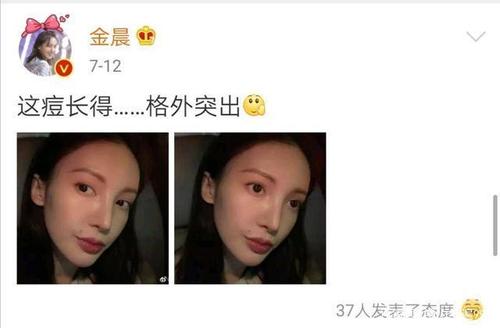 金晨因爆痘颜值遭质疑?乘风破浪的姐姐,长痘也长得