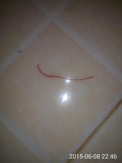 小便拉出的虫子,这是什么虫呀?怎么会这样的?好可怕