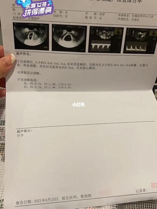 胎心胎芽_胎心_备孕_怀孕_怀孕备孕接好孕_母婴_孕产