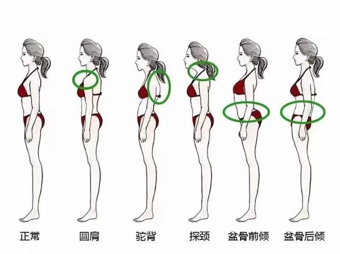 生活中常见的不良体态