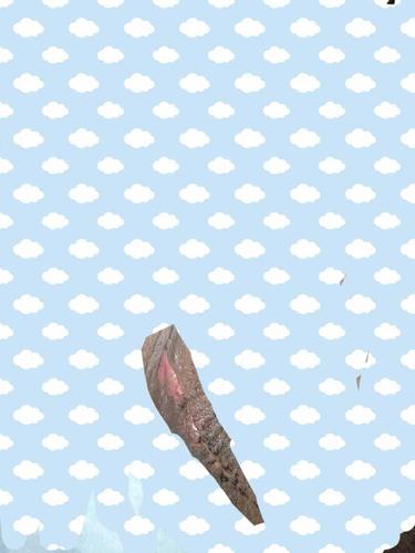 关于侧切伤口,有图慎入 - 2014年11月妈妈帮 - 妈妈帮