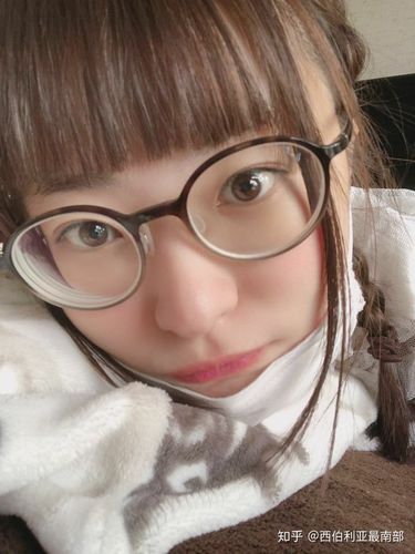 高度近视导致的大大鱼泡眼肿泡眼我觉得挺好看的.