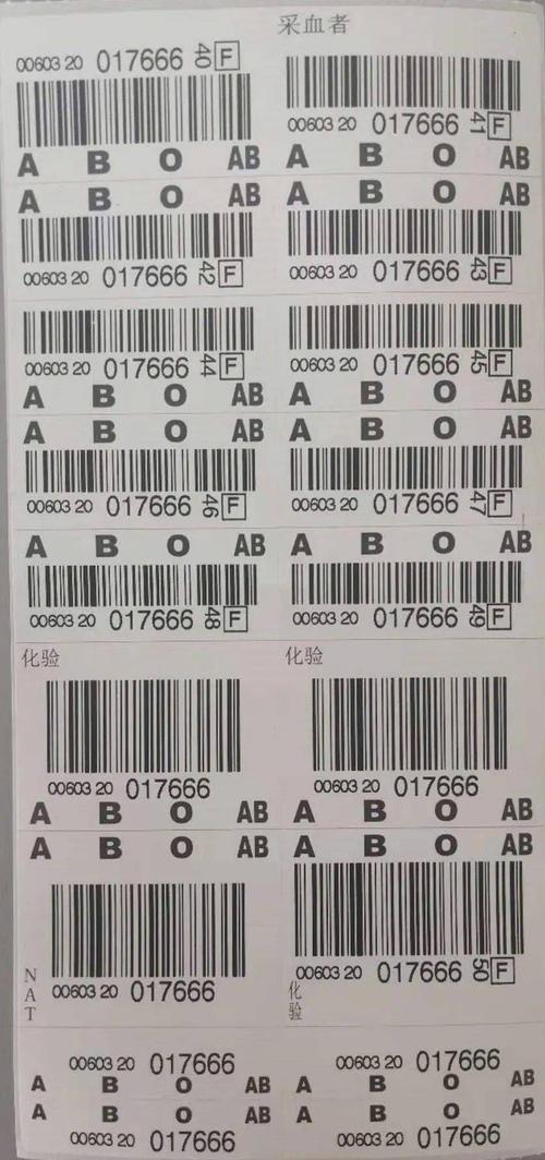 小标签大用途——血袋上的条形码