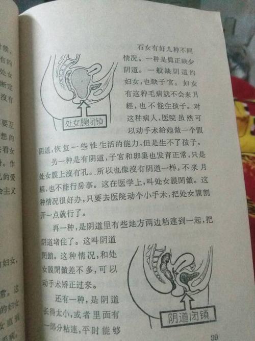 石女能过夫妻生活吗?无子宫无阴道