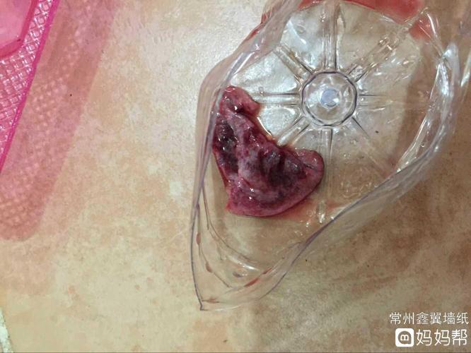 宫外孕有什么症状?这掉出来的是孕囊吗?