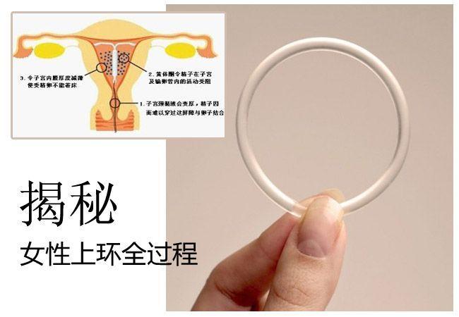 避孕环图(女性上环图解)