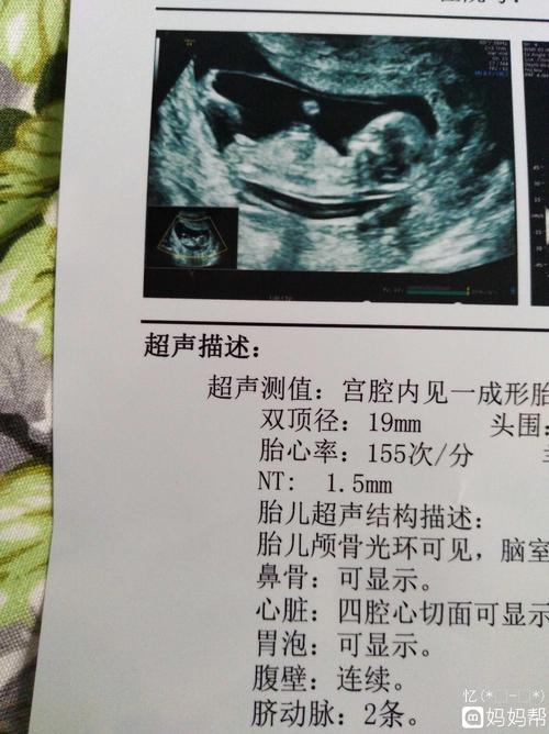 nt顺利通过有会看男孩女孩的吗我都拼三了