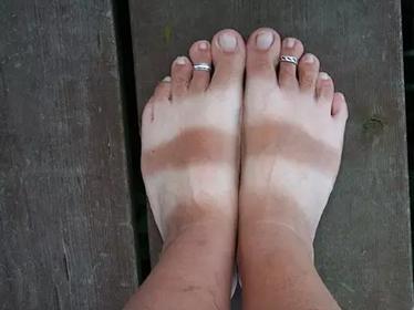 人很美,脚很丑是一种什么体验?