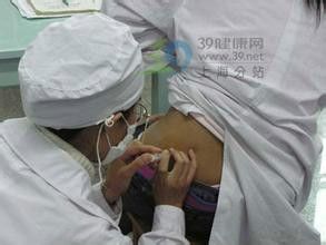 减轻肌肉注射的疼痛