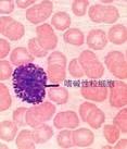 嗜碱性粒细胞和肥大细胞