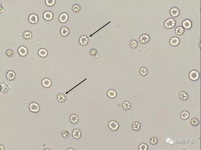 其它 红细胞 写美篇 红细胞 red blood cell 形态与血液中的一致.