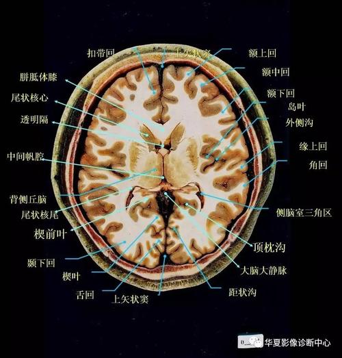 大脑各叶分界标志三沟五叶