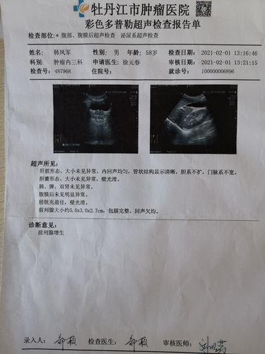 腹部彩超检查,肝胆胰脾未见明显异常