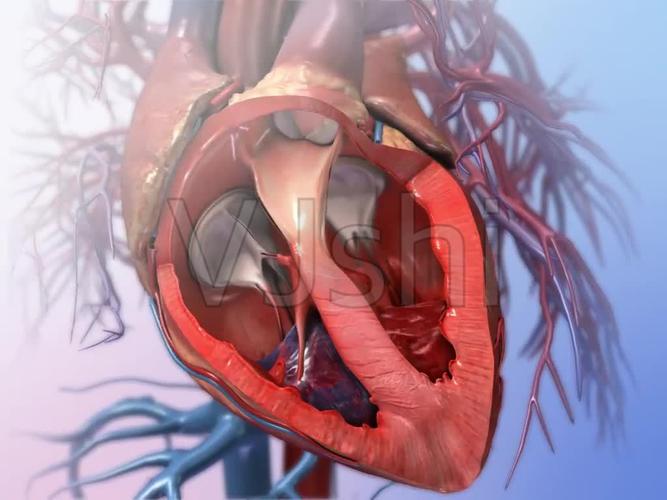 心脏二尖瓣脱垂三维机理动画_1024x768_高清视频素材