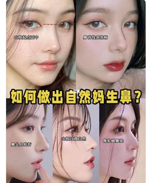 自然款_思南公馆攻略_柔美怎么样_内眼角_匹诺曹怎么样_美妆_医美