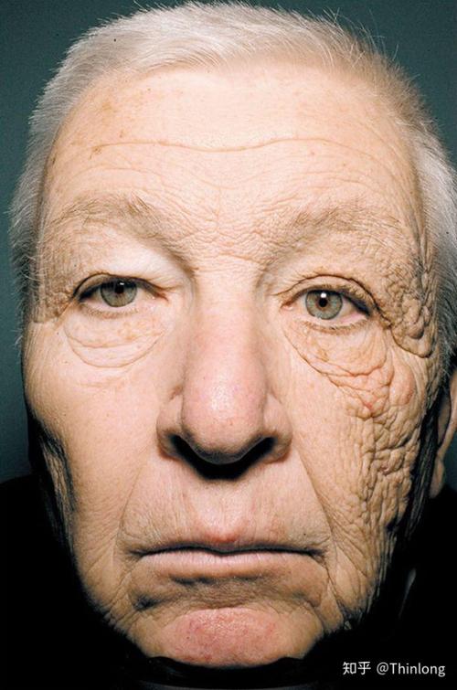 如何科学预防皱纹?