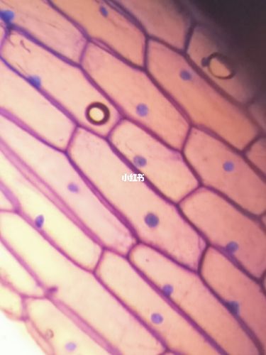 显微镜下的洋葱鳞茎内表皮细胞_炒面_标记我的生活_医疗健康_医疗健康