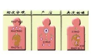 hdn),系指母,子血型不合引起的同族免疫性溶血;已发现的人类26个血型