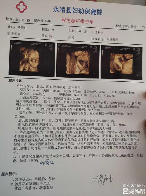 四维彩超一次通过,想知道怎么看男女