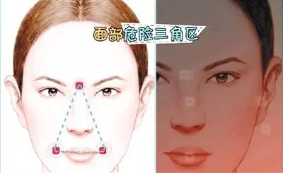 五,脸部三角区:怕挤伤