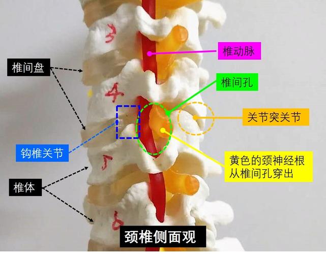 主要包括4个:钩椎关节,椎间盘,椎间孔,关节突关节