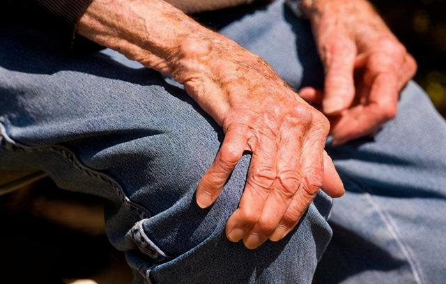 为什么会得重症肌无力,主要的症状表现有哪些呢?