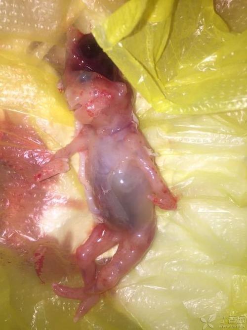 一头胎孕妇产检发现后药物流产,13周胎儿