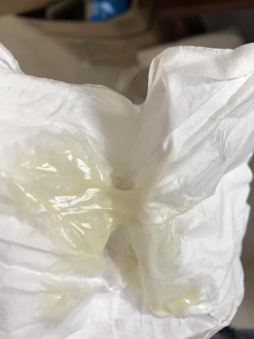 有图慎入 帮我看下这样的白带是水样还是脓样