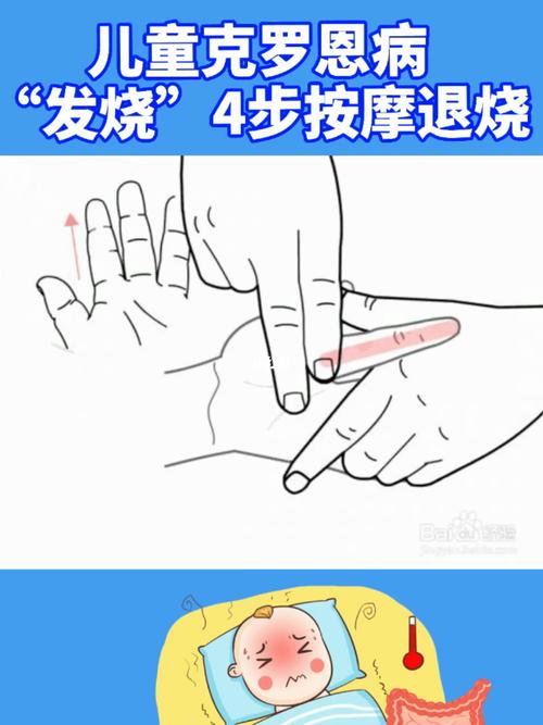 儿童克罗恩病发烧4步按摩退烧_退烧_发烧_按摩_我要上