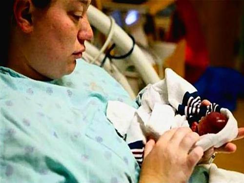 孕妇怀孕22周被迫早产,取出胎儿后医生吓到腿软!怪孕妇无知