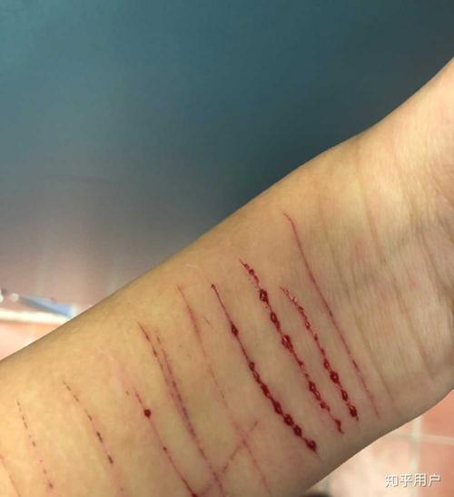 为了一个男生自残值得吗?